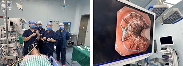 Restoring the "Gate of Breath": Advanced Interventional Pulmonology for Complex Airway Obstructions