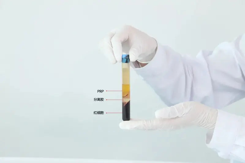 PRP Therapy: A Breakthrough Treatment for Musculoskeletal Pain